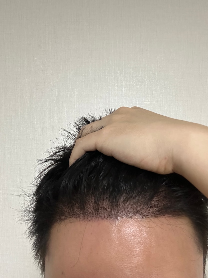 후