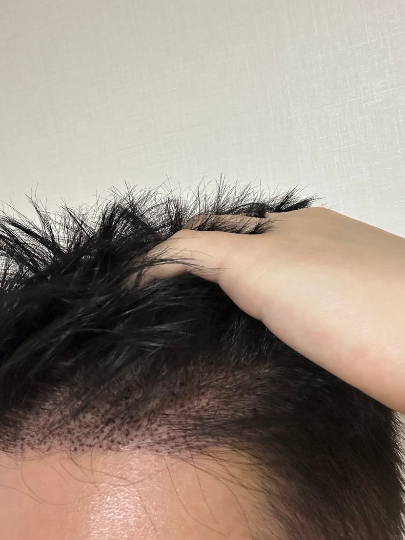 후