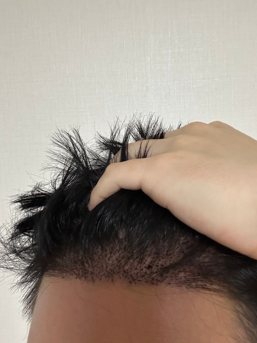 후