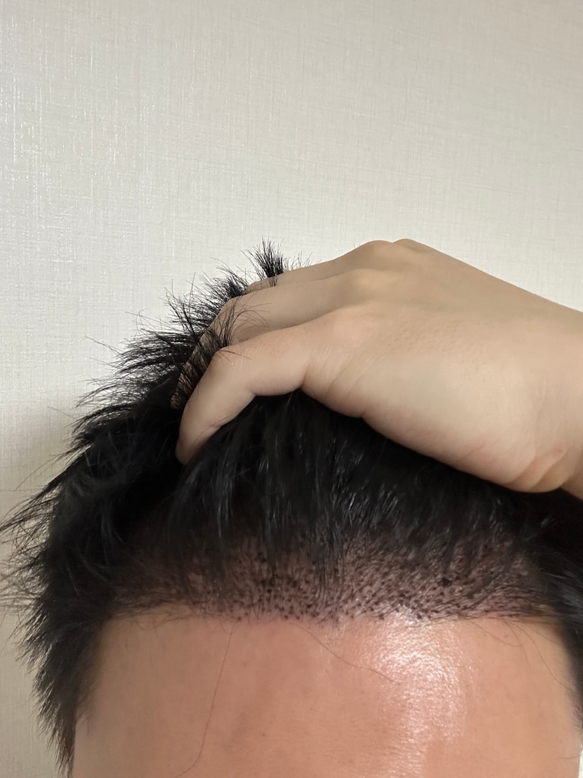 후