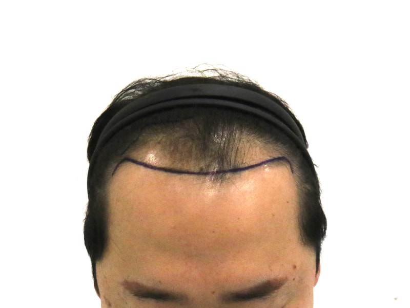 1000032415.jpg