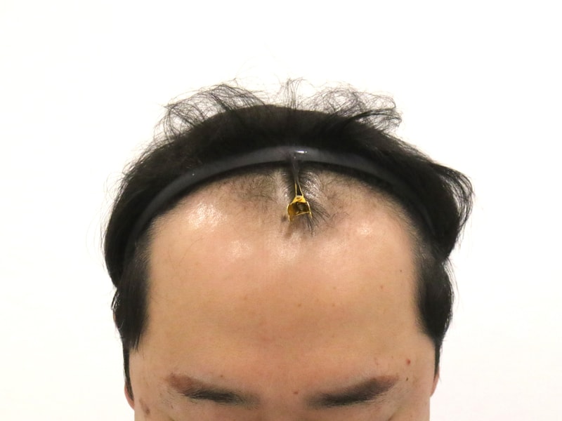 1000032414.jpg