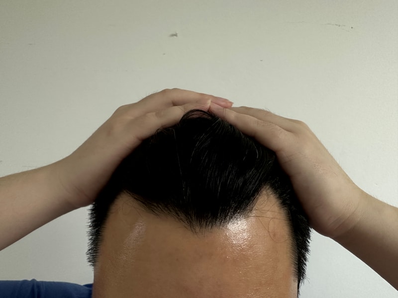 수술전2.jpg