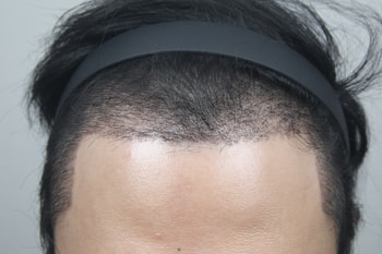 1개월