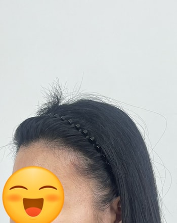 수술전