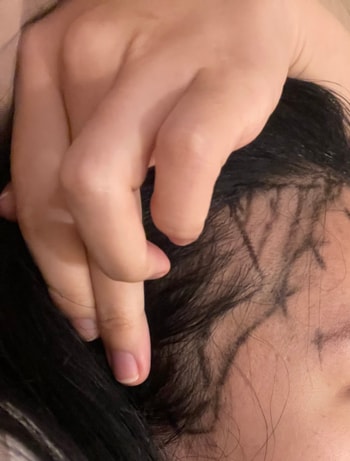 수술당일 디자인