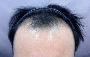 수술전