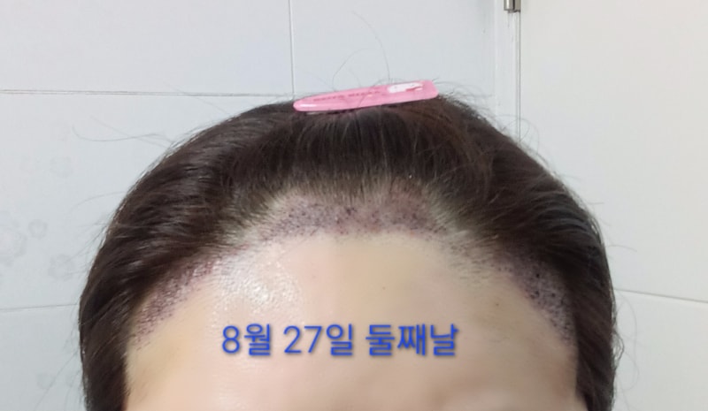 1000114192.jpg