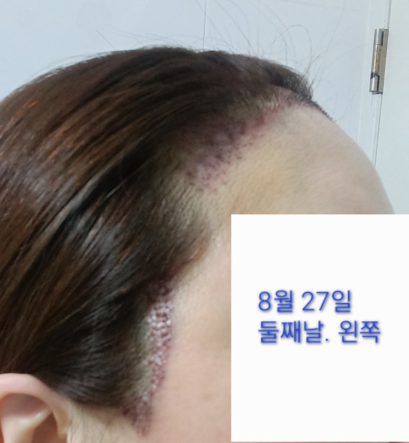 1000114193.jpg