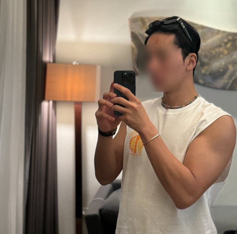 압구정 모우림 의원 30대 남성 절개 2900모 찐 후기