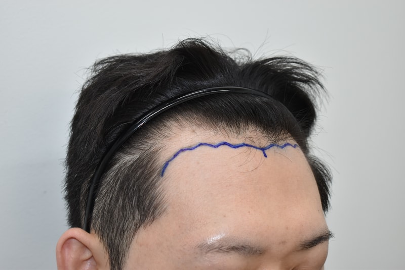12637-2026이규형__수술전디자인 (4).JPG