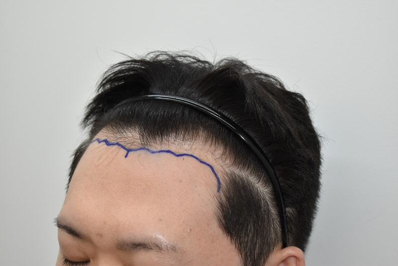 12637-2026이규형__수술전디자인 (8).JPG