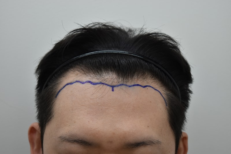 12637-2026이규형__수술전디자인 (2).JPG