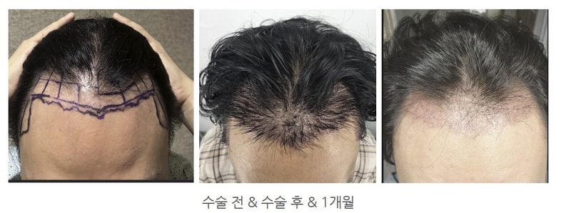 스크린샷 2026-09-11 203846.jpg