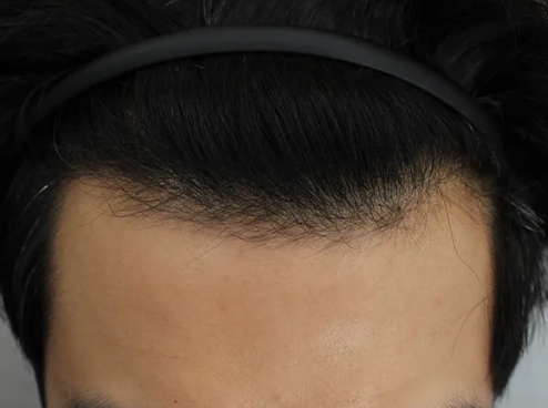 20260915_182253.png