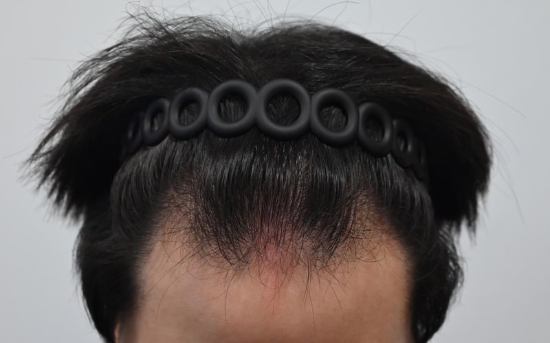 수술전1.jpeg