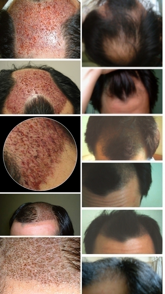 라할 89일차 후기(라할에서 하신분들 질문 있습니다)
