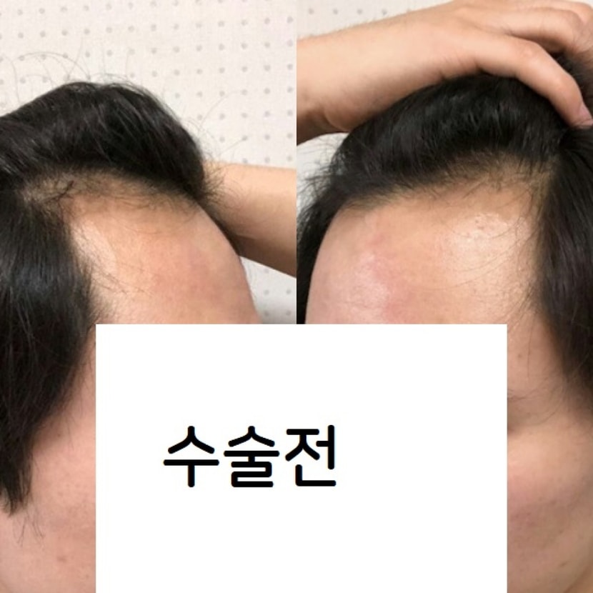 좌우사진 찍어봤습니다 잘됬으면 좋겠네요
