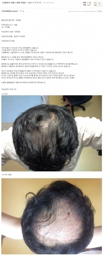 ㅁㅈㄹ에서 수술받으신분 동반탈락 후기 올라왔는데 끔찍하네요