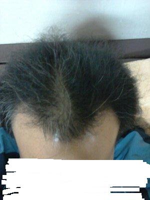 이틀전에 이식했습니다.