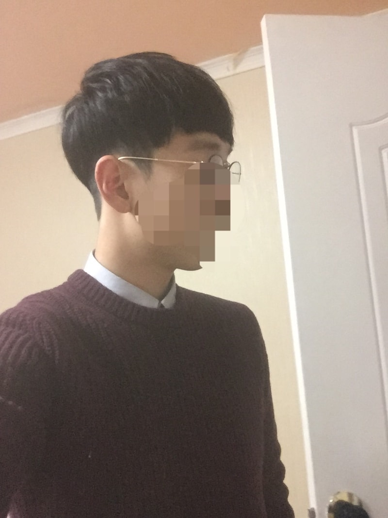 이식 17일차  미용실후기