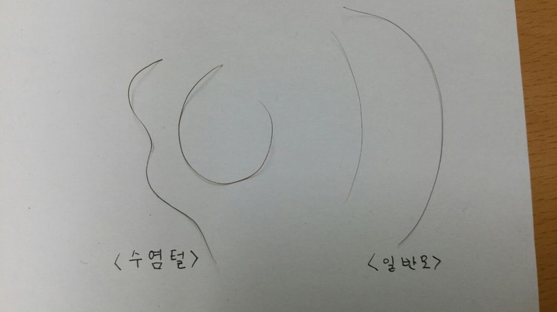 체모(수염)와 후두부 모발  비교
