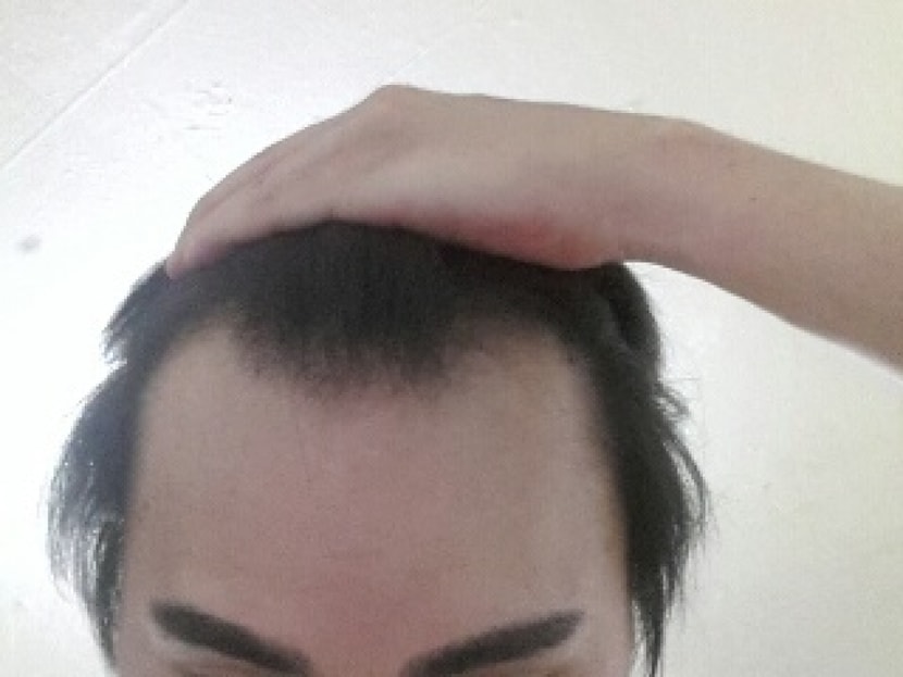 m자