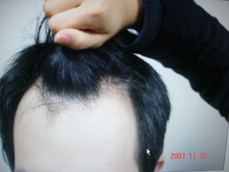DR.라할 후기 (사진추가)