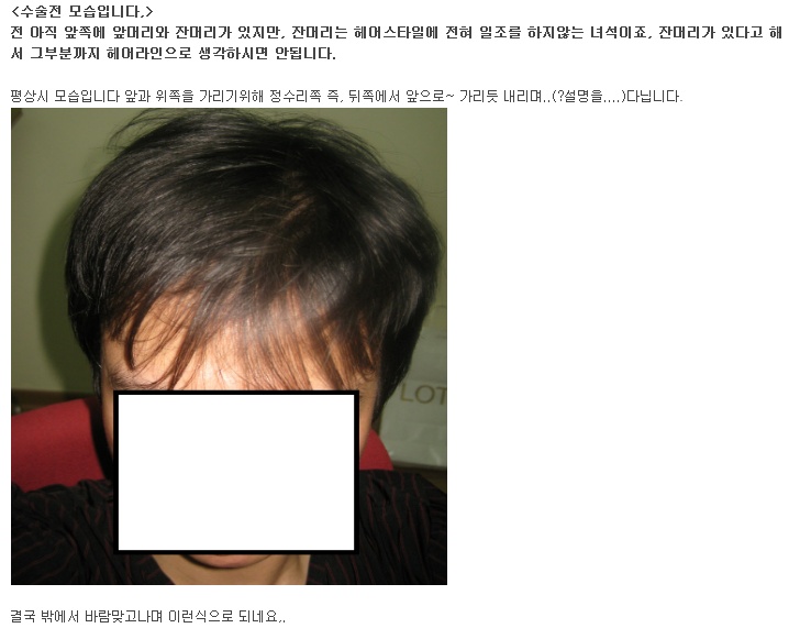 "아머리야" 앙카라 가다!! ＜수술전&넋두리＞