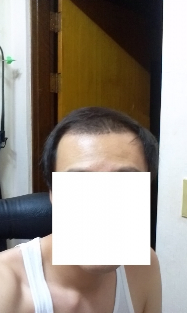 얼굴이 길어보이네요 ㅡㅡ;; 입벌려서 그렇답니다 ㅋ
