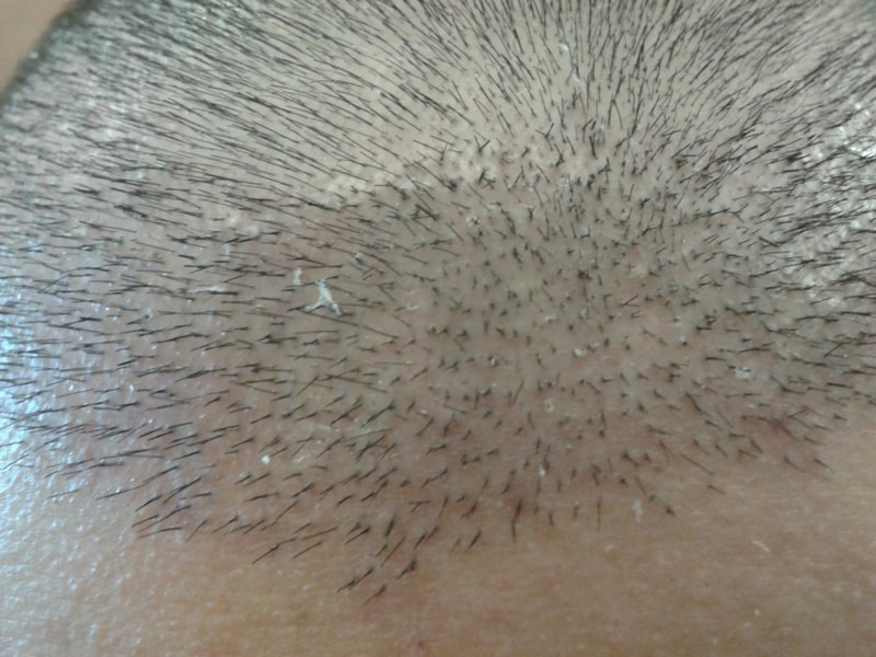 7days after.jpg
