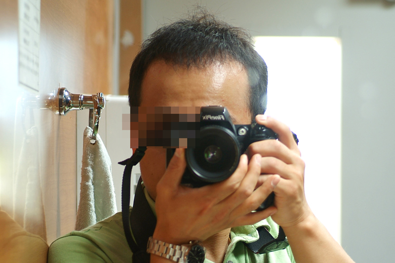 06수술후4개월20일.jpg