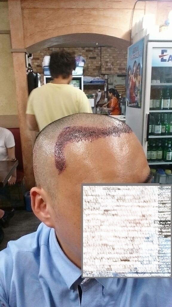 머리우위.jpg