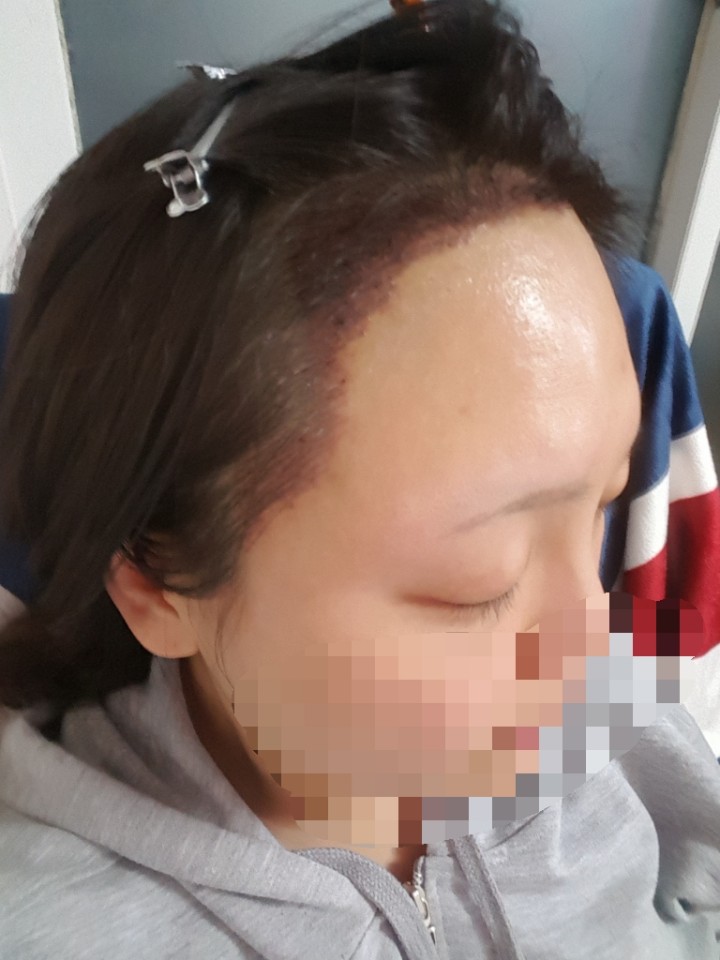 우측.jpg