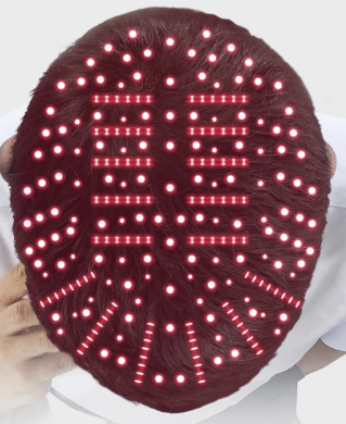 20240206_250개레이저조사_윗모습.png