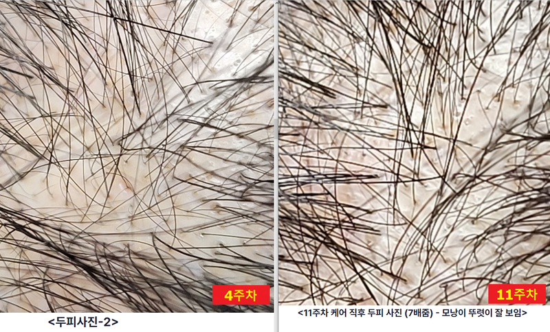 20240414_4주,11주비교.png