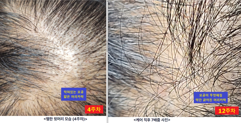 20240414_4주,12주비교.png