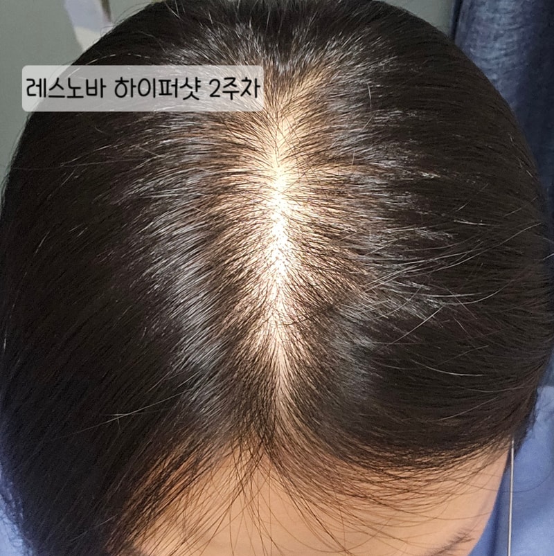 KakaoTalk_20260108_230139501_01.jpg