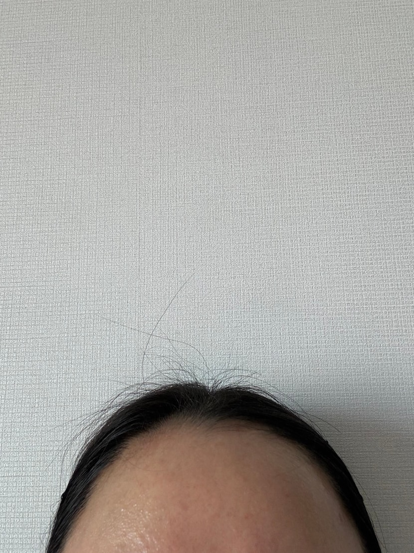 전