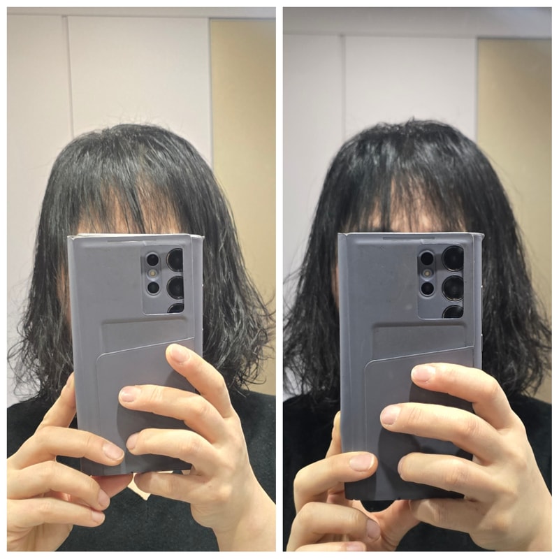 려 루트젠 뿌리 볼류머  첫회 사용후기