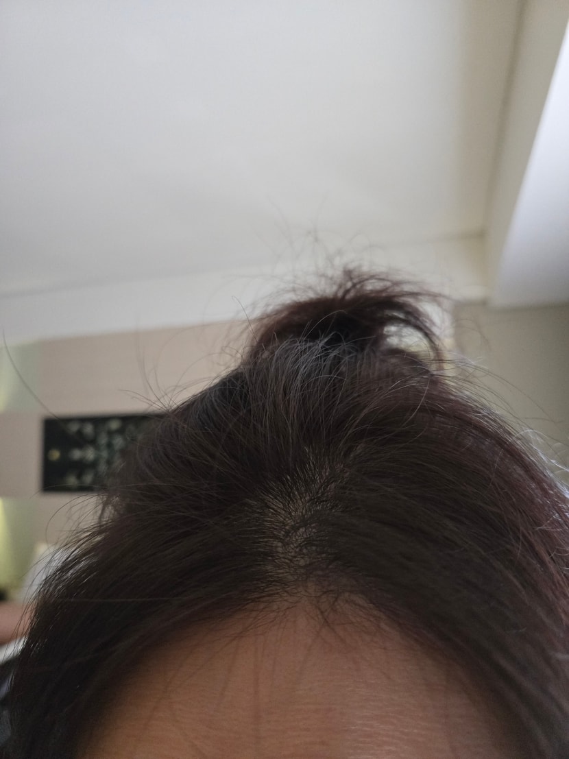 정수리 볼륨 업