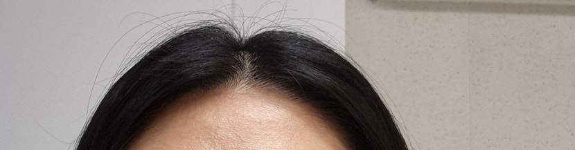 전