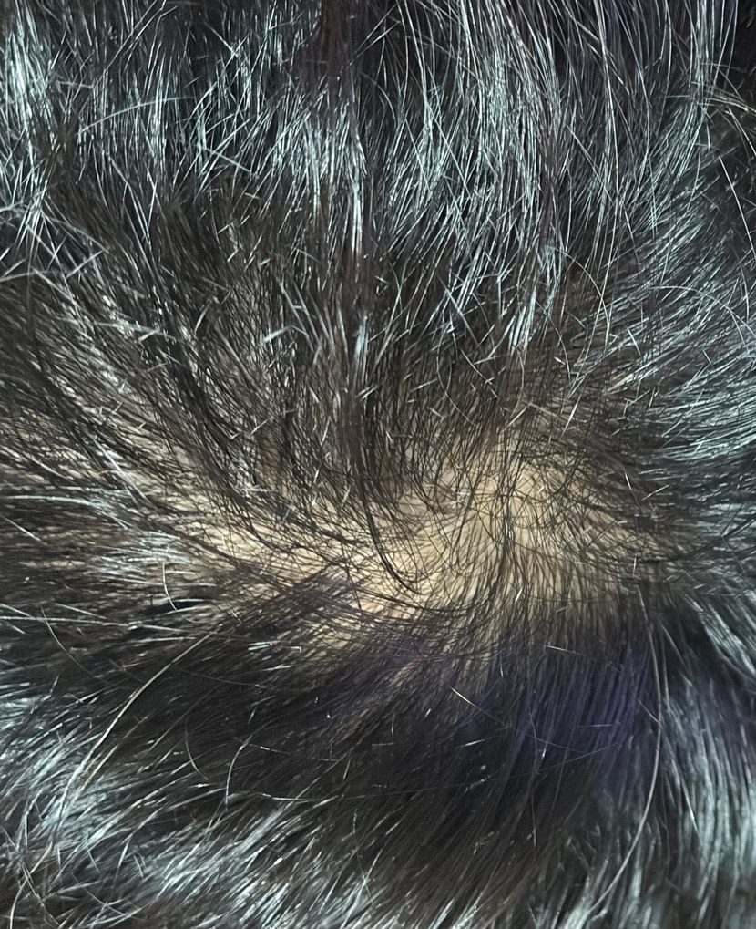 12주차 사용 후