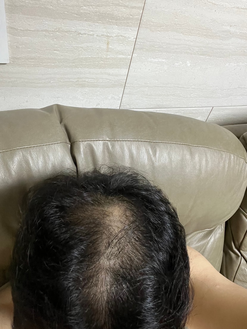 시용전