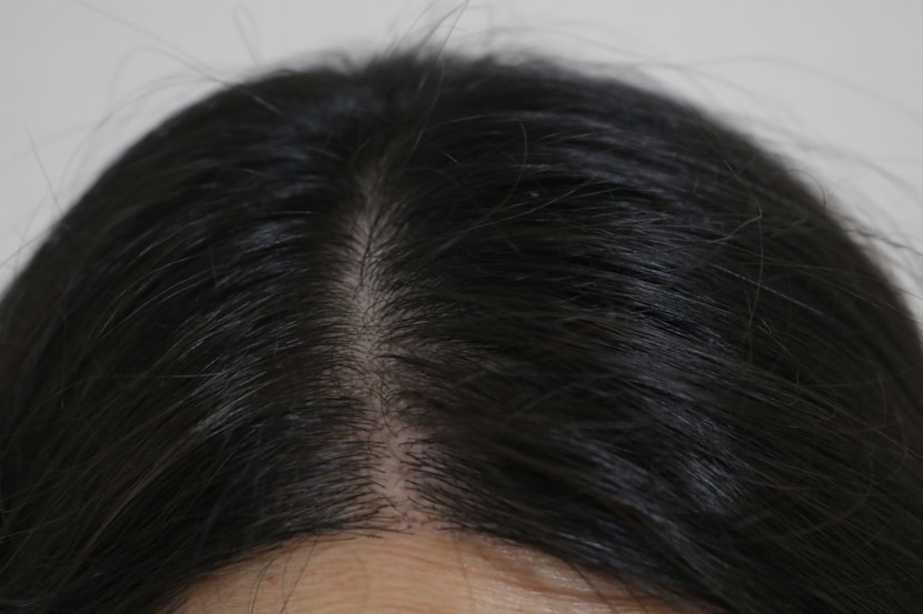 려 루트젠 뿌리 볼류머 사용전 두피
