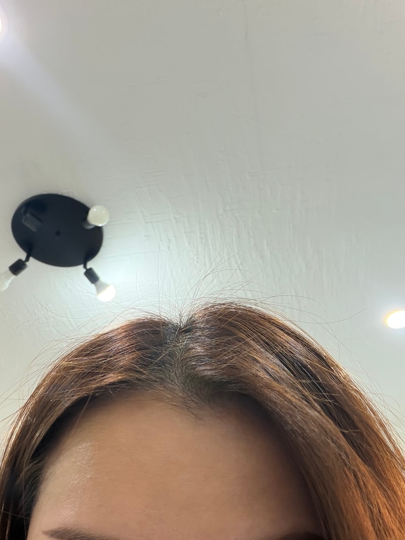 려 루트젠 뿌리 볼류머 2주차 후기