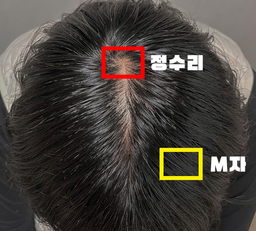 촬영 부위