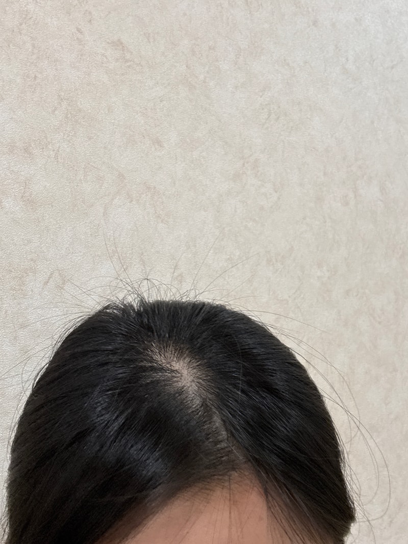 다훈이개븅신.jpg