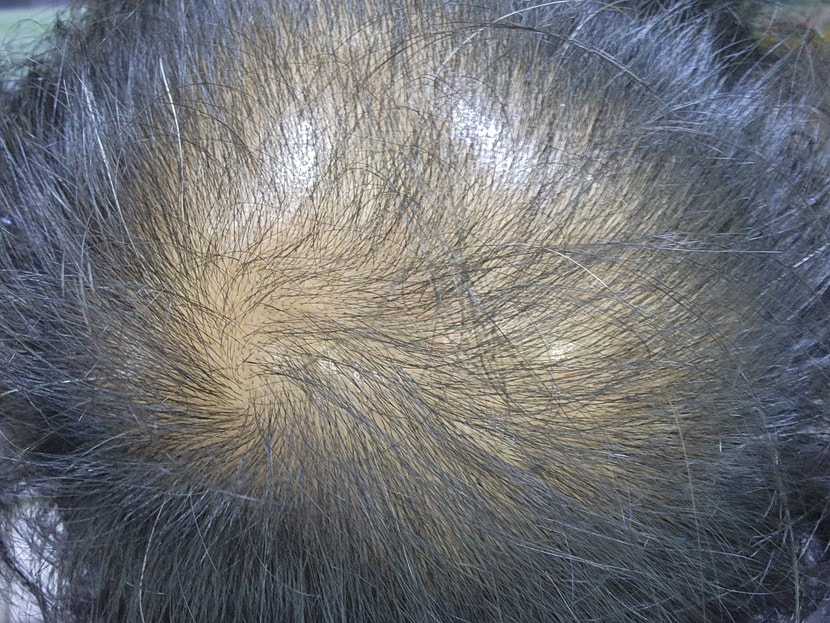 4/1 빛에 따라 다르지만 약간 어둑해지는거 같네요 ㅎ