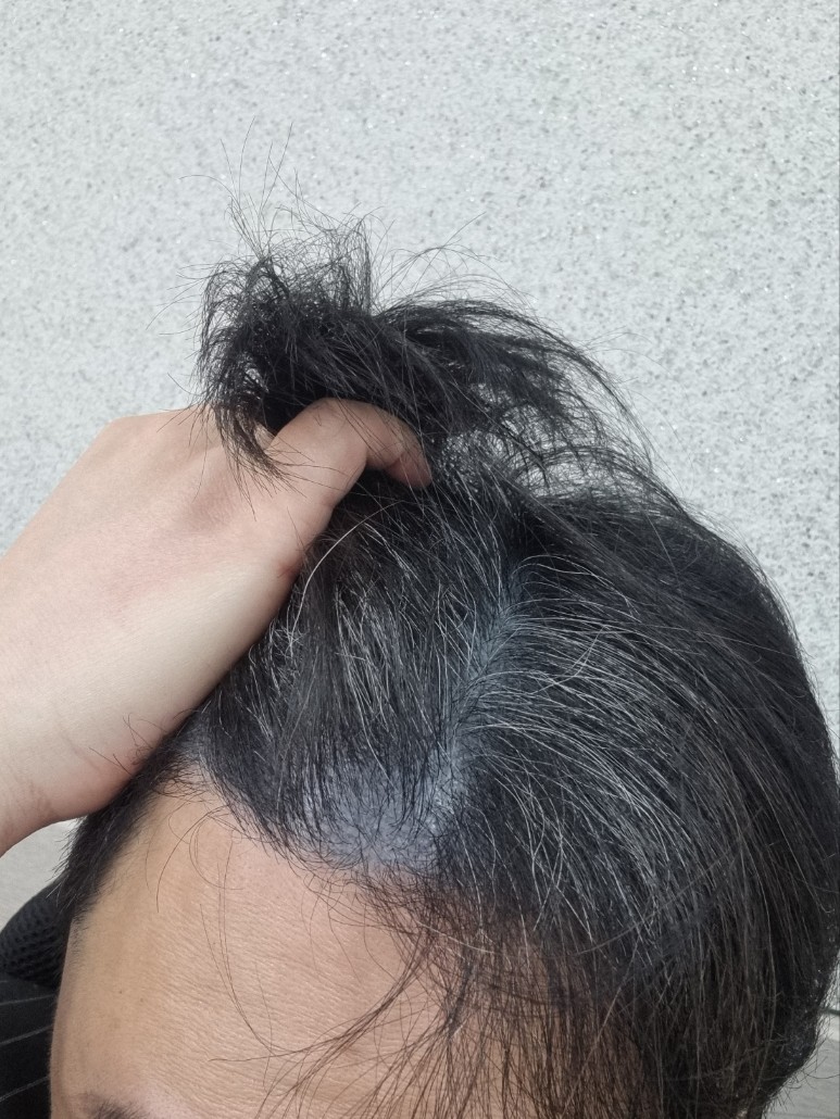 케어놀로지 샴푸 3주차